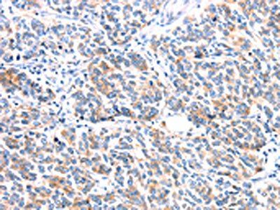 ERBB3 Antibody