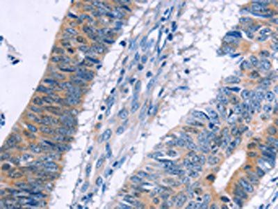 ERBB3 antibody