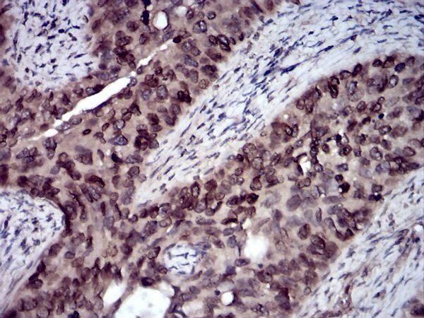 ERBB4 Antibody