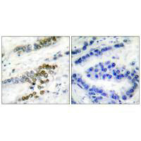 ERCC1 antibody