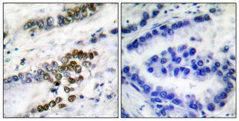 ERCC1 antibody