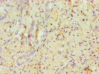 ERCC2 Antibody