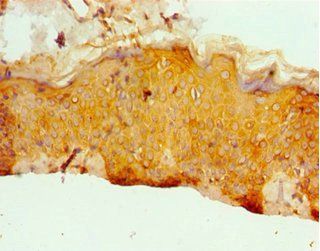 ERCC2 Antibody