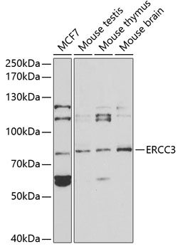 ERCC3 antibody