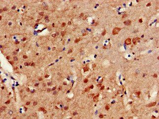 ERCC4 Antibody