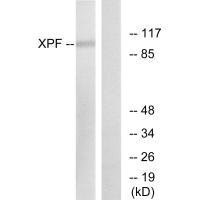 ERCC4 Antibody
