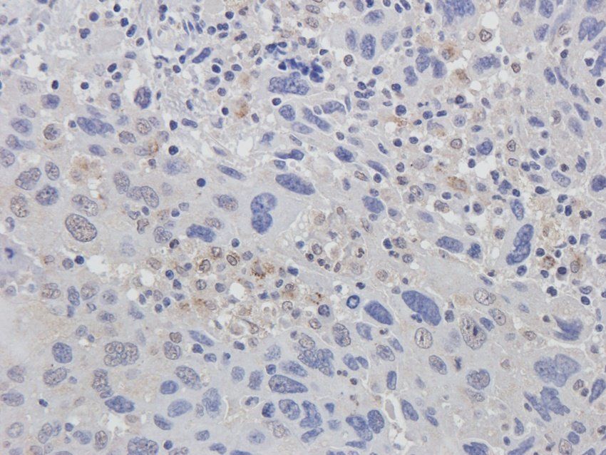 ERCC5 antibody