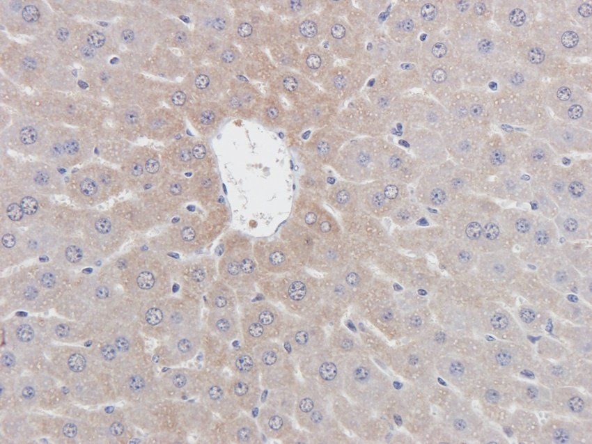 ERCC5 antibody