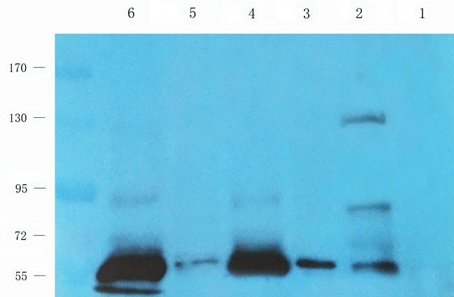 ERCC5 antibody