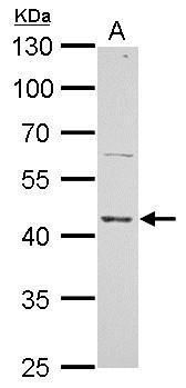 ERCC8 antibody