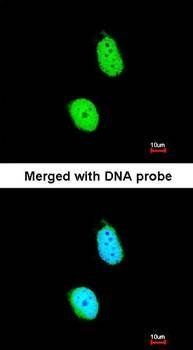 ERCC8(CSA) antibody
