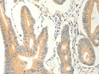 ERG Antibody