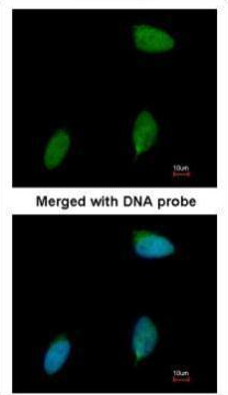 ERG antibody [C3], C-term