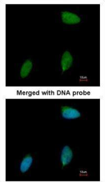 ERG antibody