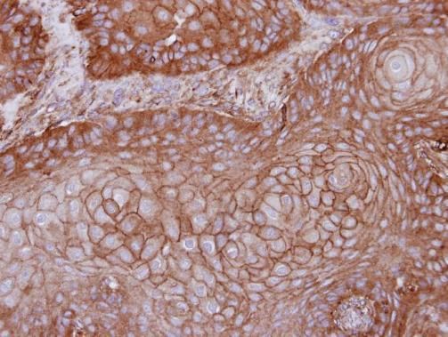 membrane palmitoylated protein 1 Antibody