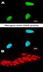ERG antibody