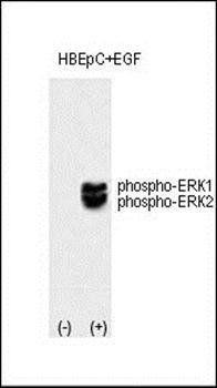 ERK1/2 (phospho-Thr202/Tyr204) antibody