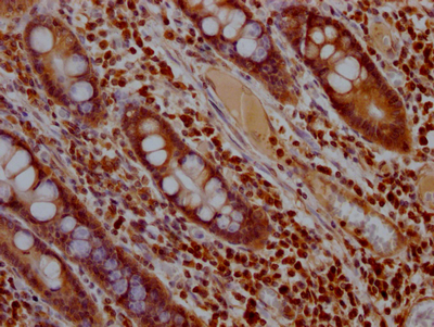 MAPK1 Recombinant Monoclonal Antibody