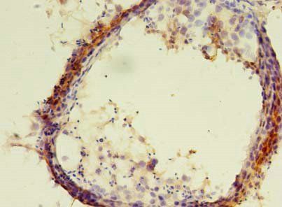 ERLIN1 Antibody