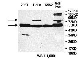 ERO1L Rabbit Polyclonal Antibody