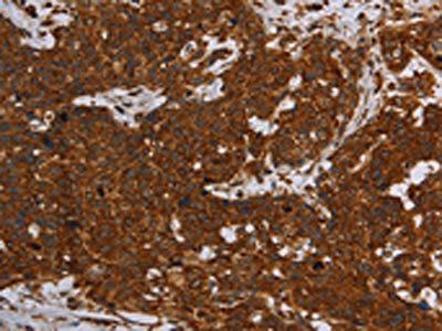 ERRFI1 Antibody