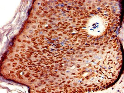 ERVK-6 Antibody