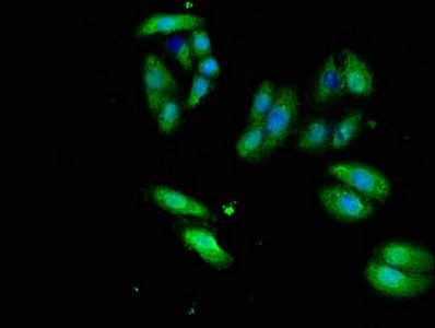 ERVW-1 antibody