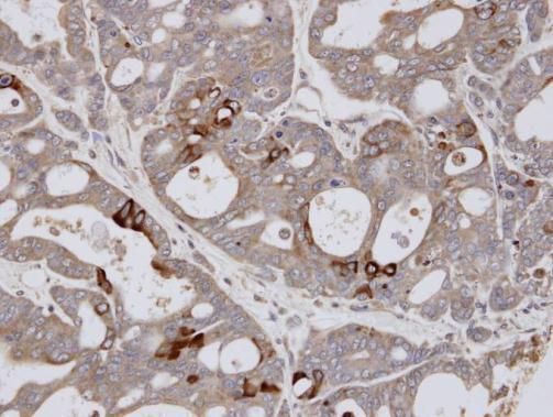 ESE1 antibody [C2C3], C-term
