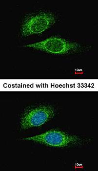 ESE1 antibody