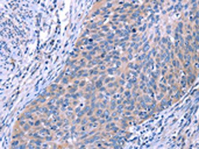 ESPL1 Antibody