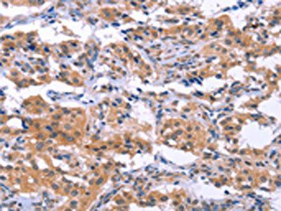 ESPL1 antibody