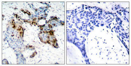 ESR1 (Ab-118) antibody