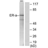 ESR1 (Ab-537) antibody
