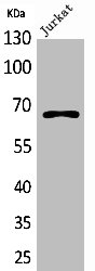 ESR1 Antibody