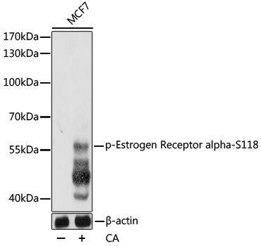 ESR1 (Phospho-S118) antibody