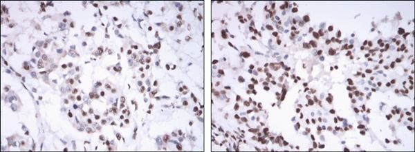 ESR1 Antibody