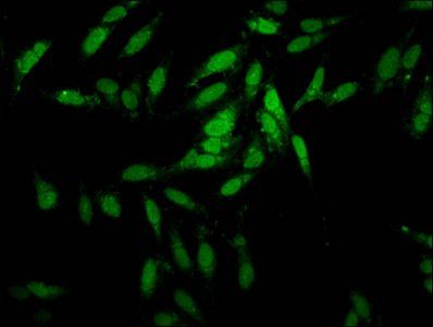 ESRP2 antibody