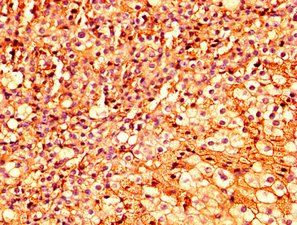 ESRP2 Antibody