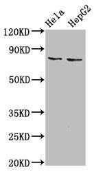 ESRP2 antibody