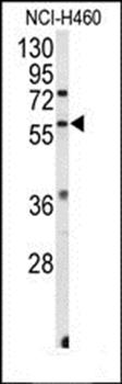 Estrogen Receptor beta antibody