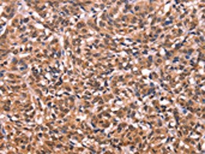ESRRB Antibody