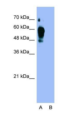 ESRRG antibody