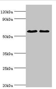 Estrogen R beta antibody