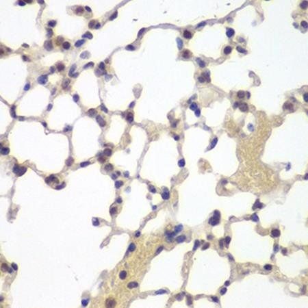 Estrogen Recepter beta2 antibody