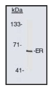 Mouse Human Estrogen Receptor Antibody