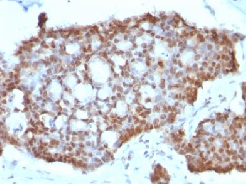 ER-beta-1 (Estrogen Receptor beta-1) Antibody