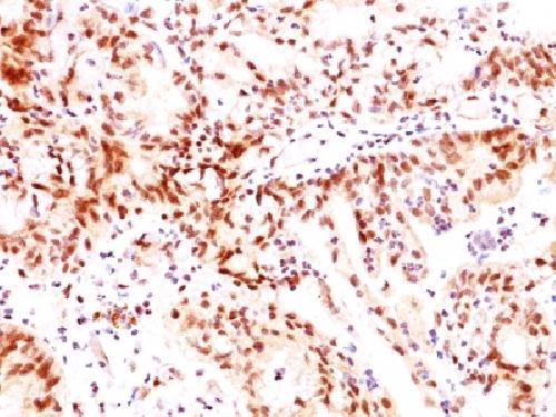 ER-beta-1 (Estrogen Receptor beta-1) Antibody