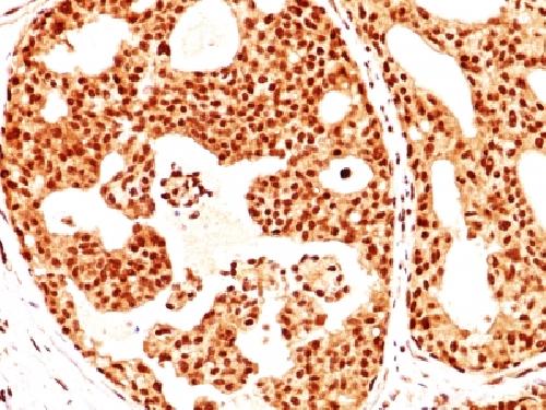 ER-beta-1 (Estrogen Receptor beta-1) Antibody
