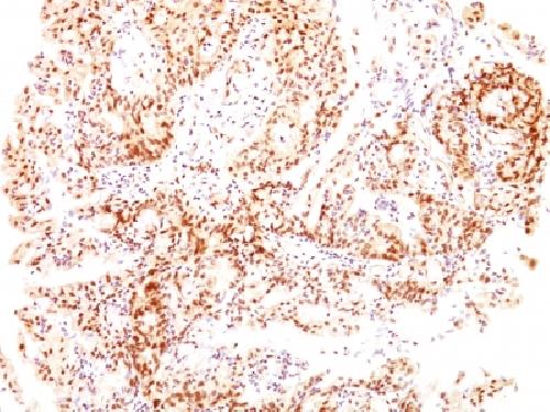ER-beta-1 (Estrogen Receptor beta-1) Antibody