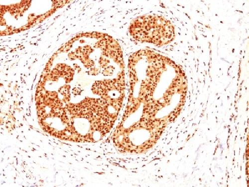 ER-beta-1 (Estrogen Receptor beta-1) Antibody